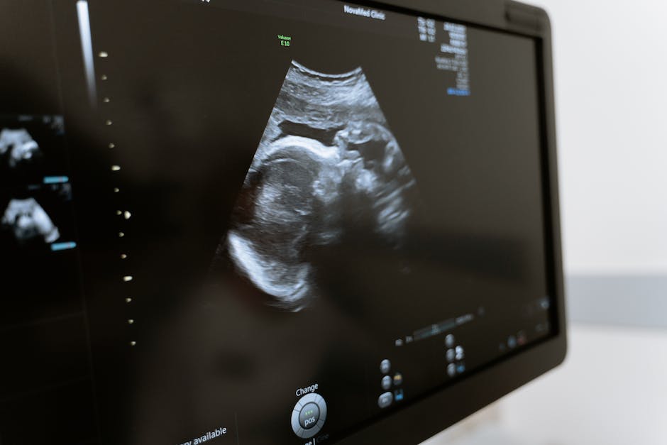 how much do ultrasound techs make in california